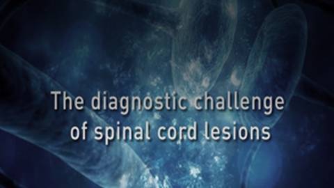 The Diagnostic Challenges of Spinal Cord Lesions in MS