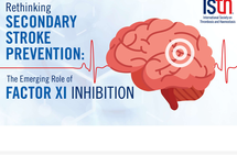 Rethinking Secondary Stroke Prevention Slide Deck