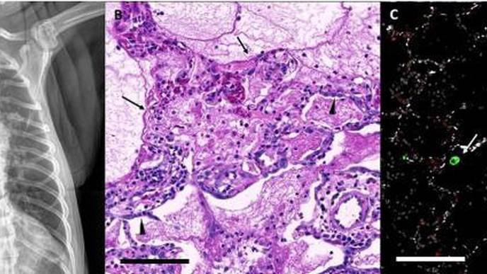 Study Identifies a Nonhuman Primate Model That Mimics Severe COVID-19 Similar to Humans