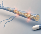 melatonin falls short in neuropathic pain crossover trial