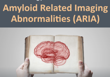 A Neurology Clinician's Guide to Amyloid Related Imaging Abnormalities
