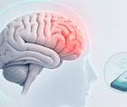 pooled trials link ct 132 to lower monthly migraine days