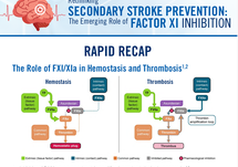 Rethinking Secondary Stroke Prevention Rapid Recap