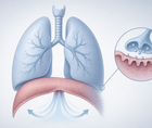 physical and respiratory training in myasthenia gravis