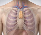 single port robotic thymectomy at miami early experience and recovery