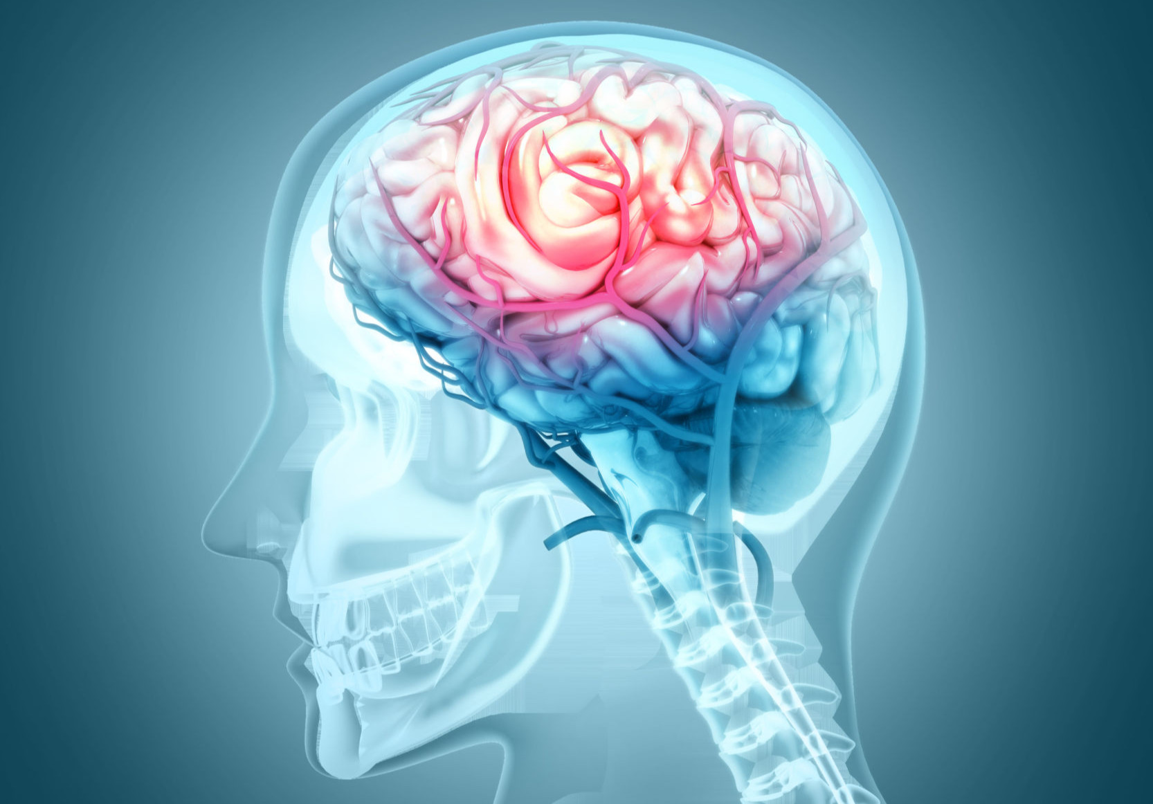 Shining a Light on the Hidden Damage of Mild Brain Injuries - - Global ...